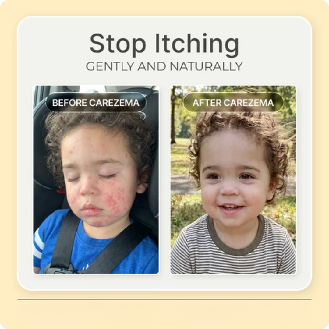 Korean Honey Eczema-Soothing Cream for your kids