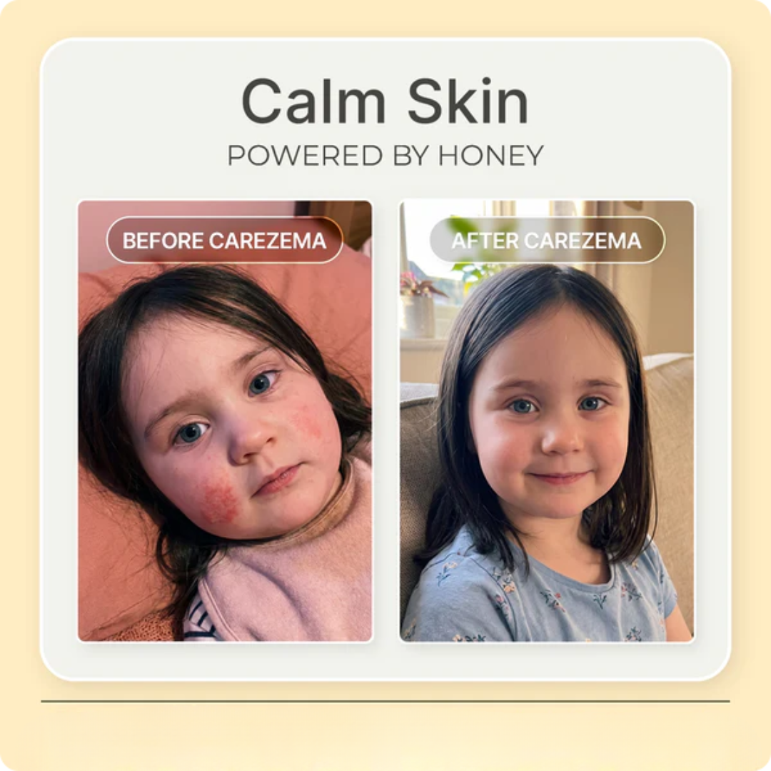 Korean Honey Eczema-Soothing Cream for your kids