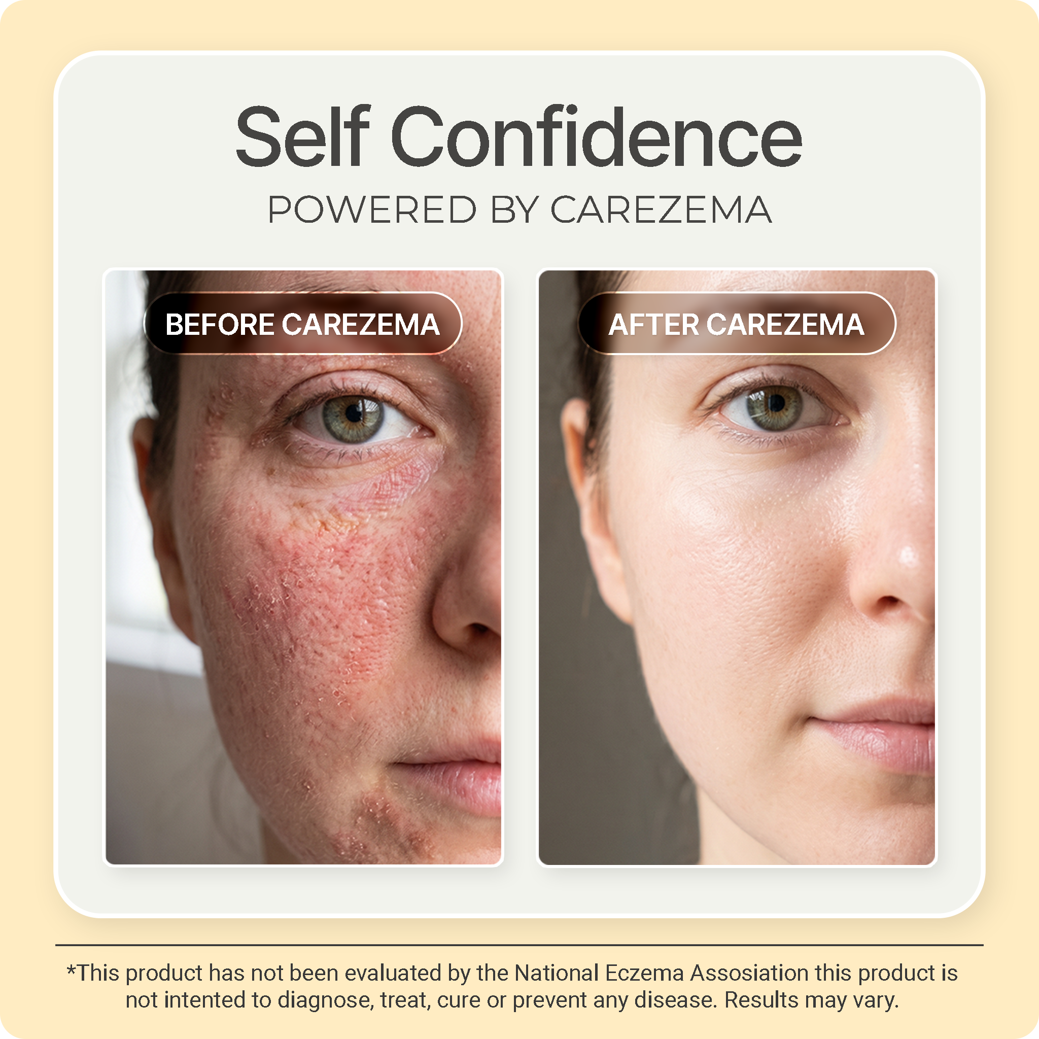 Korean Honey Eczema-Soothing Cream for woman