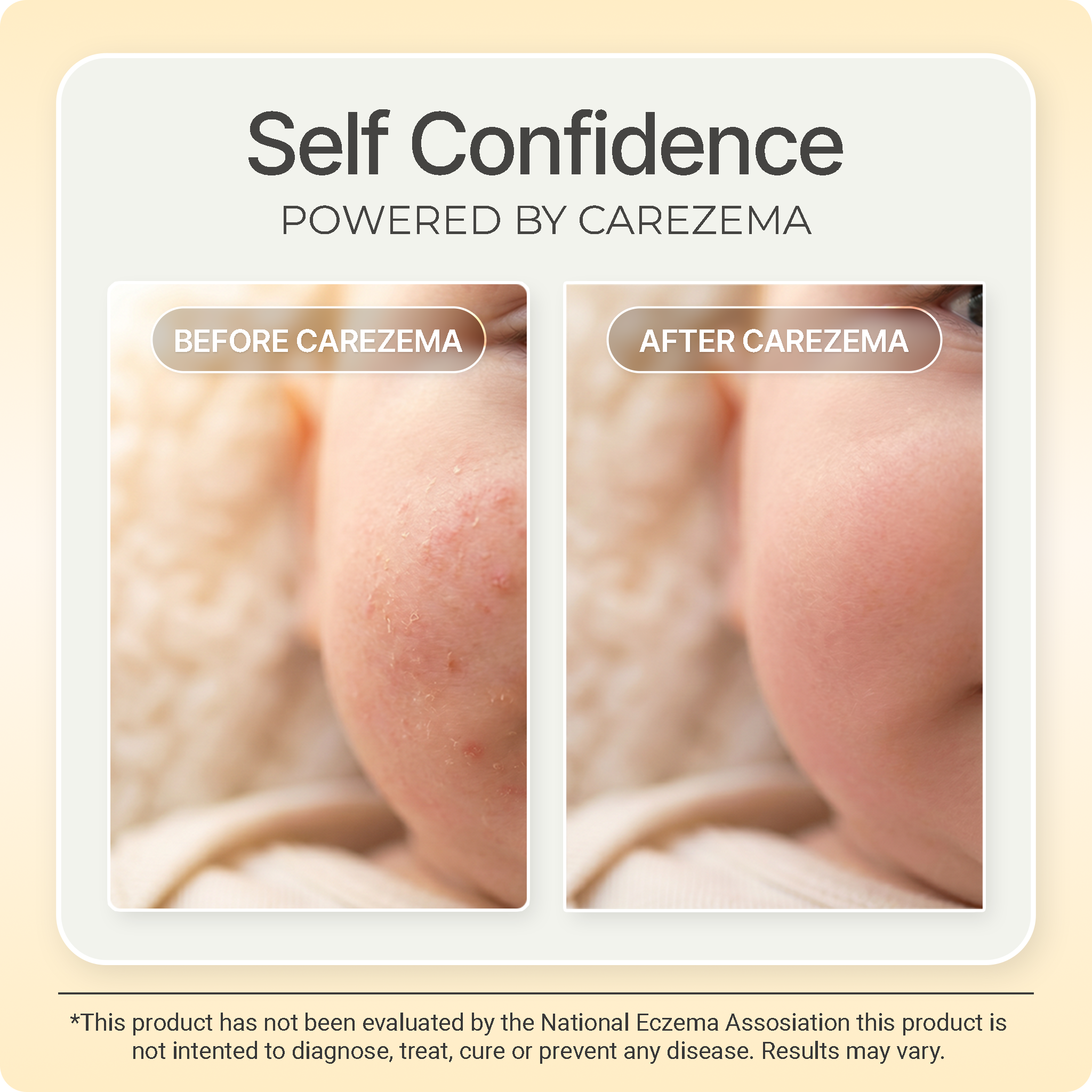 Carezema Eczema Soothing Honey