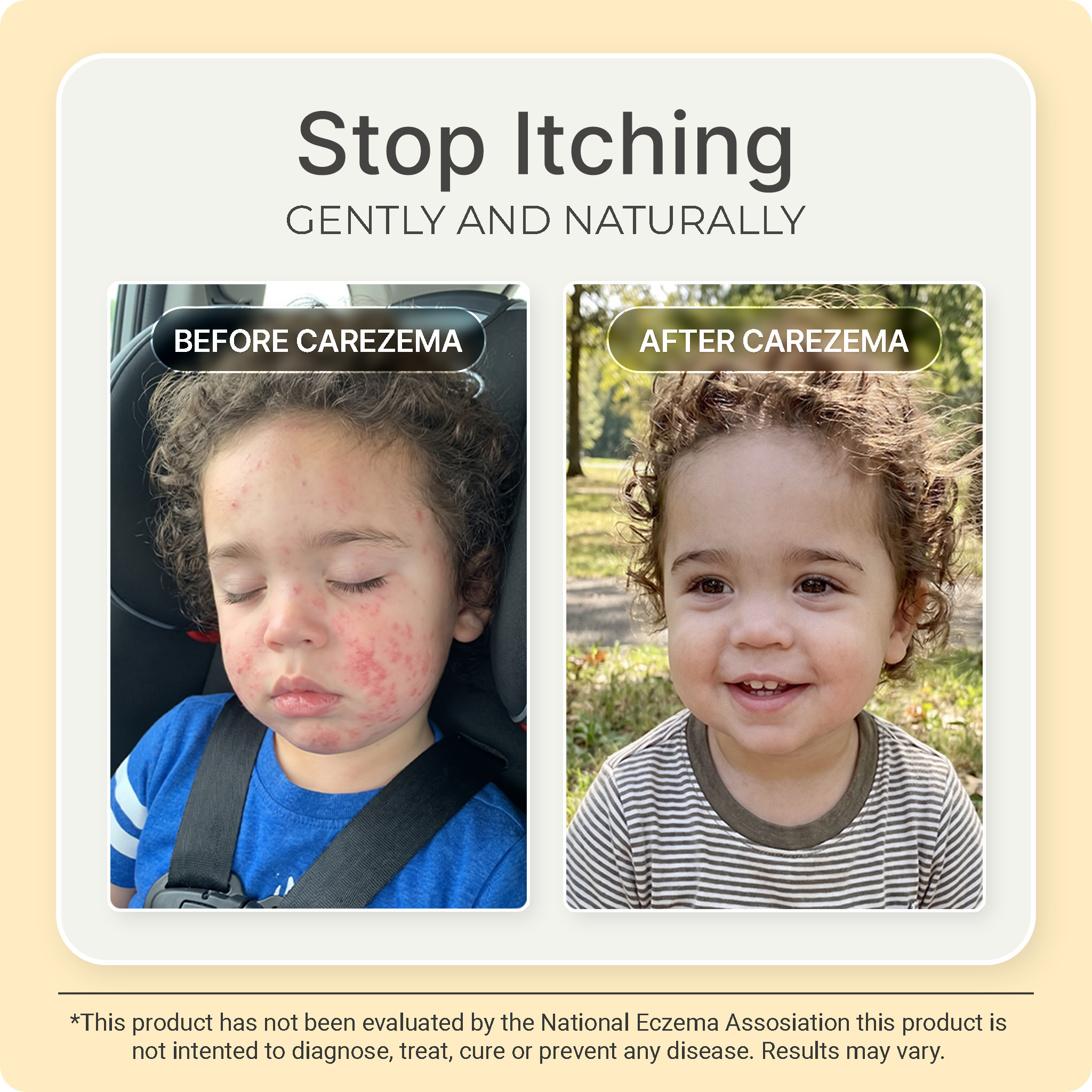 Korean Honey Eczema-Soothing Cream for your kids