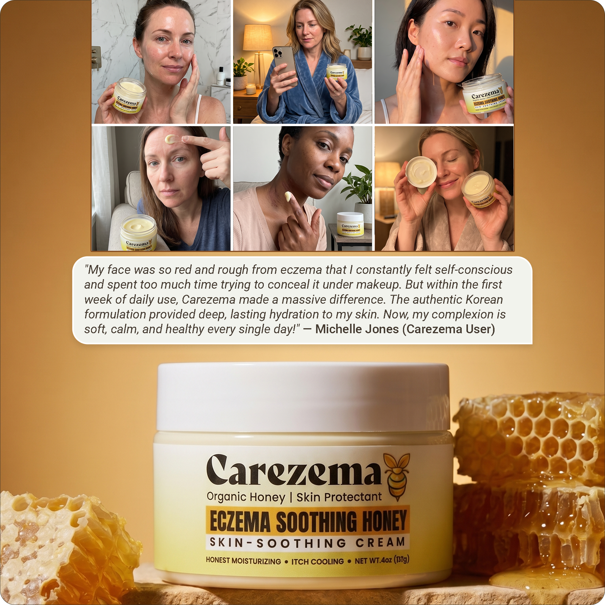 Korean Honey Eczema-Soothing Cream for woman
