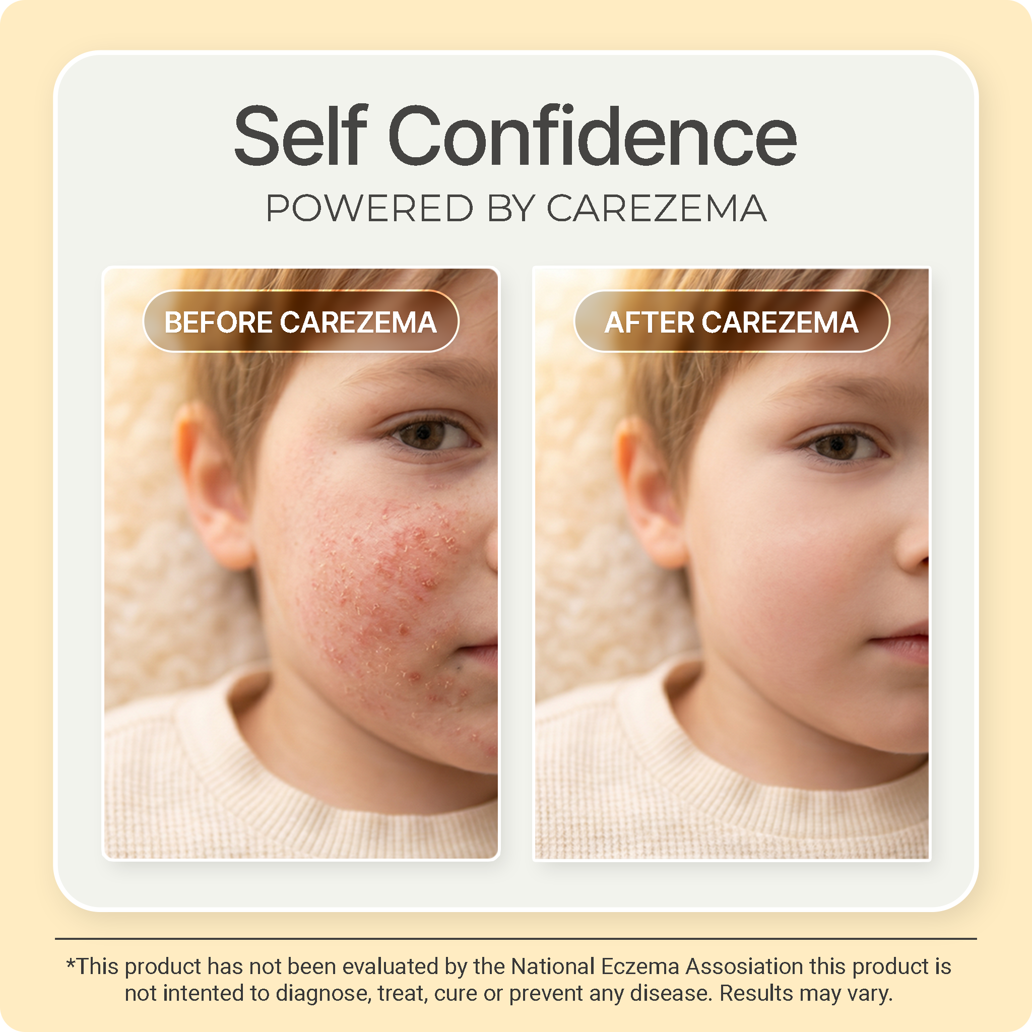 Korean Honey Eczema-Soothing Cream for your kids