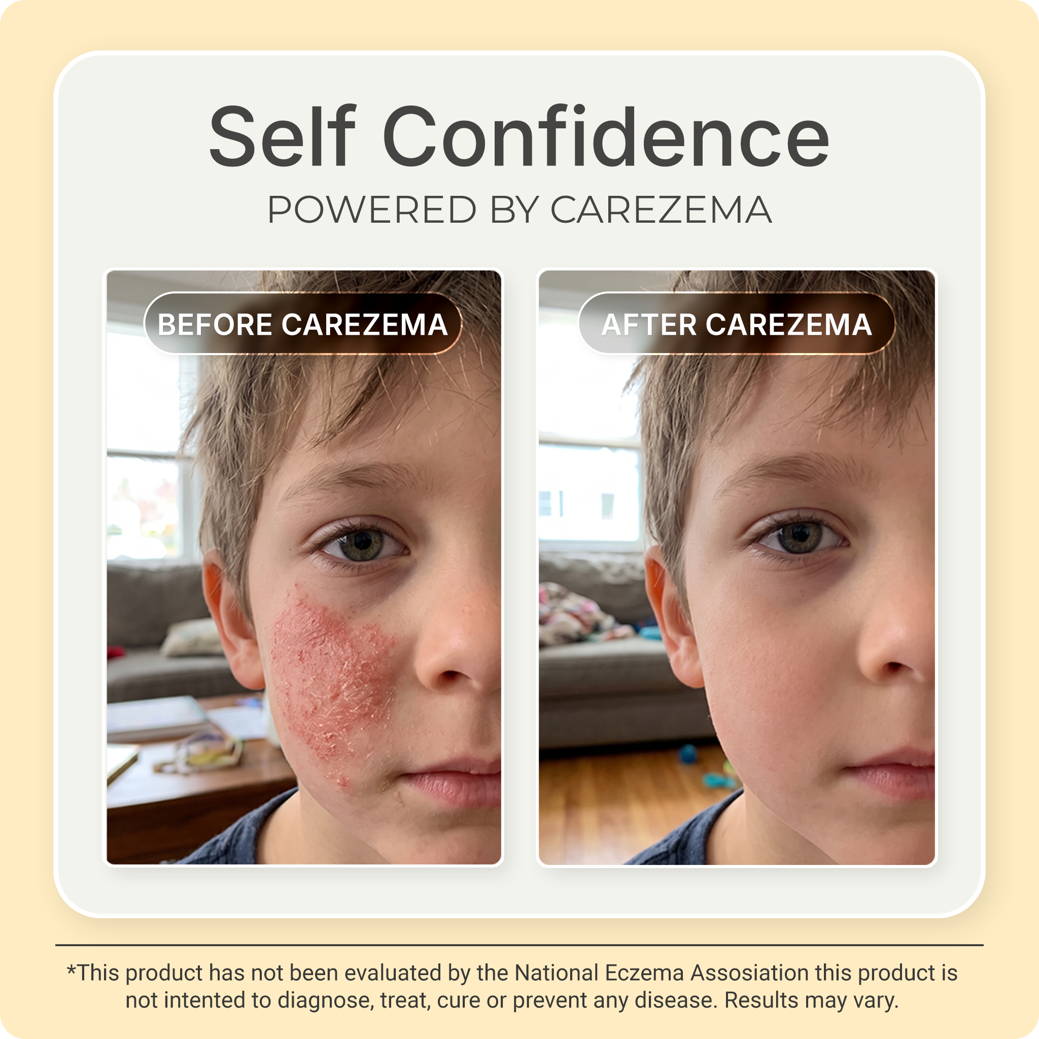 Korean Honey Eczema-Soothing Cream for your kids