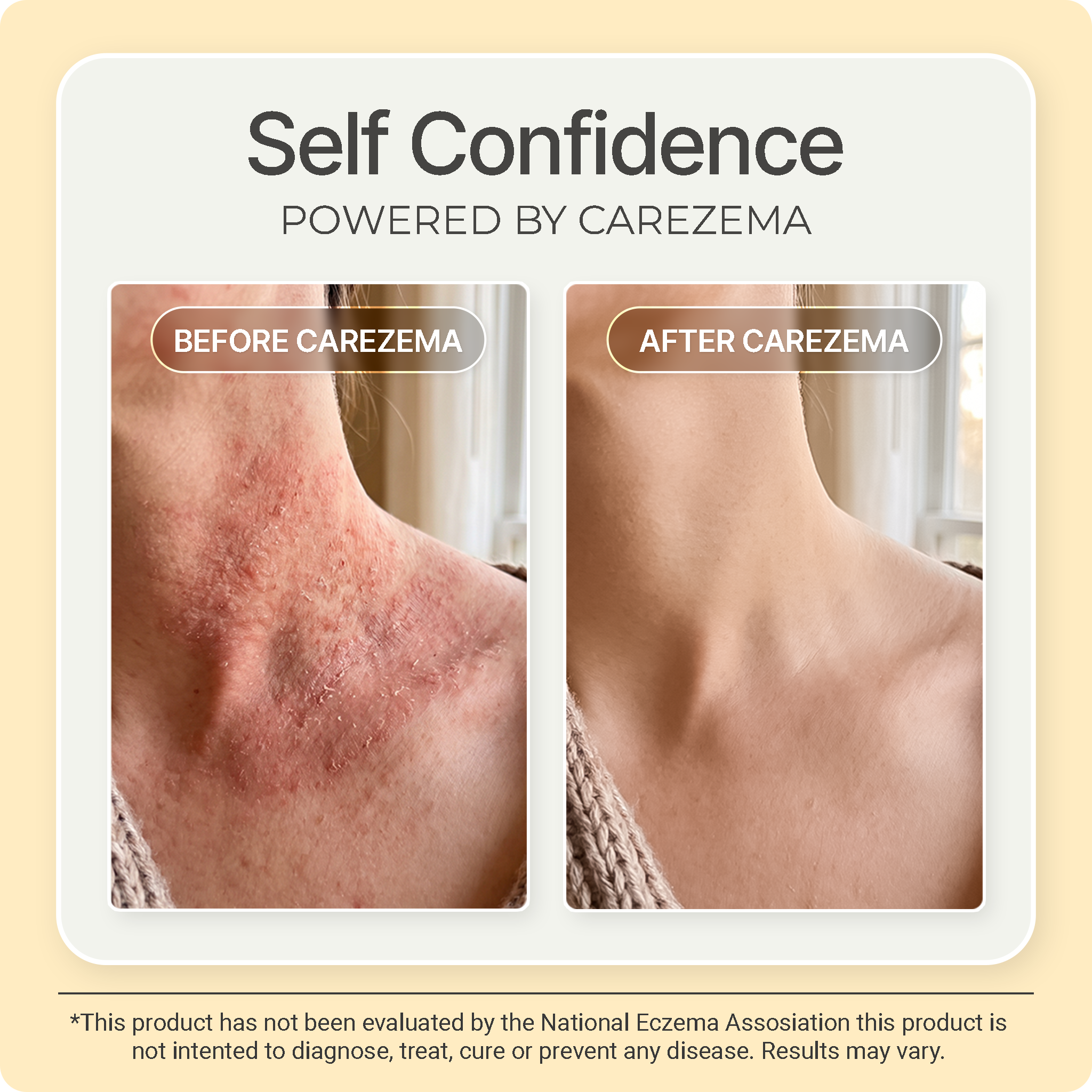 Korean Honey Eczema-Soothing Cream for woman